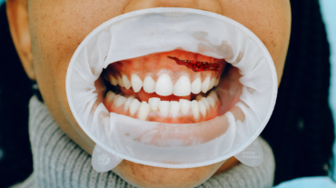 Untitled design (15)